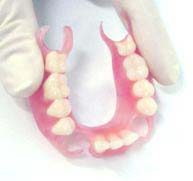 нейлоновые протезы в стоматологии Апекс-Д